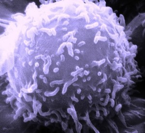 Elektronenmikroskopisches Bild eines Lymphozyten. © public domain.