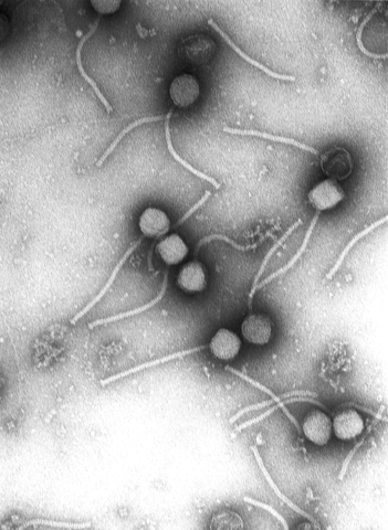 Gamma Phage, der Bacillus anthracis lysieren kann, unter dem Elektronenmikrokop© Vincent Fischetti & Raymond Schuch. CC BY 2.5