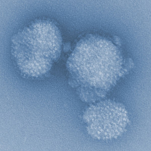 Influenza-Viren in elektronenmikroskopischer Vergrößerung. © HZI / Rohde