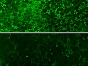  Entzündungsfördernde Makrophagen (grün) überfluten das Fettgewebe stark übergewichtiger Mäuse (oben, Kontrolle). Die Einwanderung löst chronische Entzündungen und Typ-2-Diabetes aus. Wird HO-1 aus Makrophagen entfernt (unten), wird deren Ansammlung im Fettgewebe unterbunden. Das verhindert Stoffwechselerkrankungen. © MPI f. Immunbiologie und Epigenetik/ A. Pospisilik 