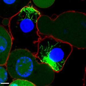 Mikroskopische Aufnahme von Makrophagen, die Inflammasome enthalten: Zuvor uniform verteilte ASC-Moleküle (grün) bilden fibrilläre Strukturen. Die Zellkerne sind blau und die Plasmamenbranen rot eingefärbt. © Eicke Latz/Uni Bonn