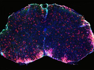 Ausschnitt des Rückenmarks von Mäusen unter dem Fluoreszenzmikroskop: DMF wirkt auf die hier rot markierten Immunzellen, deren Aktivität die Schäden an den Nervenzellen verursacht (blau: Zellkerne). © MPI f. Herz- und Lungenforschung. 