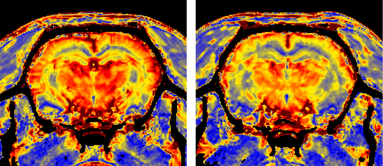 Blutvolumen-Messung eines Rattengehirns mit Magnetresonanztomographie (MRT); gute Durchblutung (hohes Blutvolumen = rot-gelb, links); geringere Durchblutung (geringes Blutvolumen = gelb-blau, rechts) (Photos: Andreas Pohlmann, Henning Reimann/Copyright: MDC)