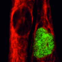 Muskelzelle (rot) mit Muskelstammzellen des Menschen (grün).  © Andreas Marg. ECRC