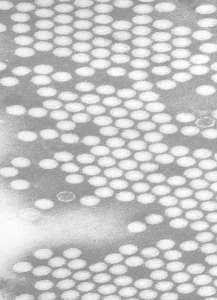 Polioviren im Elektronenmikroskop. © public domain.