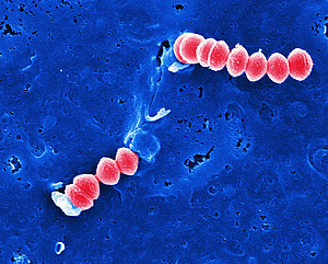 Streptococcus pyogenes (rot) dringt in humane Endothelzellen (HUVEC) ein.  © HZI / Rohde