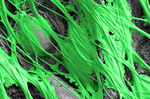 Rasterelektronenmikroskopische Aufnahme einer Haftscheibe (grün), die auf einem Blatt (grau) gesponnen wurde. © Jonas Wolff