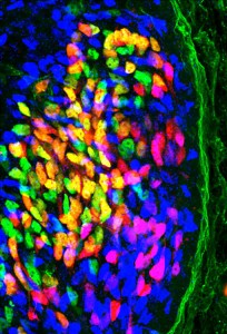  Während der Entwicklung schicken Nervenzellen (hier in blau, grün und gelb) ihre Axone zu bestimmten Beinmuskeln. Treffen die EphA4-Rezeptoren der auswachsenden Nervenzellen nicht mehr auf frei zugängliche Ephrine, finden die Fortsätze vieler Nervenzellen (violett) nicht mehr zu ihren Partnerzellen. © MPI für Neurobiologie/ Gatto 