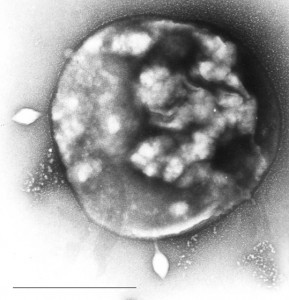 Archebakterium von Stamm Sulfolobus, das mit Viren infiziert ist.  © Xiangyux. public domain.