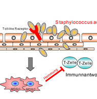 Die Grafik stellt den Zusammenhang von Staphylococcus aureus Infektionen und der Bildung von MDSCs dar, die Immunantworten in der Haut blockieren. ©  T. Biedermann / TUM
