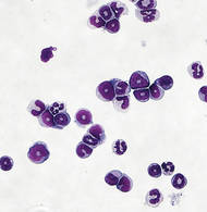 Myeloid-derived suppressor cells (MDSCs) (histologische Färbung), die aus Mäusen isoliert wurden. © Y. Skabytska / Universität Tübingen