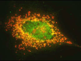 Die fluoreszenzmikroskopische Aufnahme zeigt die Ubiquitin-Ligase FBXO25 (grün) und das überlebenssichernde Protein (rot) in einer Krebszelle, die gerade den Zelltod einleitet. Das gelbe Signal zeigt an, wenn beide Proteine am selben Ort sind. © Bassermann / TUM