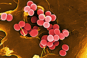 Das Bakterium Staphylococcus aureus verursacht Osteomyelitis, eine schwer zu bekämpfende bakterielle Erkrankung. © Rohde/HZI