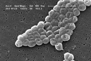 Acinetobacter baumanii. © Janice Carr. public domain.