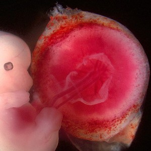 Menschliche Plazenta mit Embryo. © Wei Hsu and Shang-Yi Chiu. CC BY 2.5