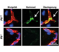 In Mäusen, bei denen das Entzündungsprotein Plasmakallikrein ausgeschaltet wurde (untere Bildreihe), entstehen in den Blutgefäßen (rot) nach einem Schlaganfall deutlich weniger Gerinnsel (grün) als in Mäusen, in denen Plasmakallikrein vorhanden ist (obere Bildreihe). Dadurch sind weniger Gefäße verschlossen (Pfeil) und die Durchblutung im Gehirn verbessert. © Eva Göb / Christoph Kleinschnitz