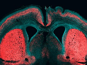Großhirnrinde eines Mausembryos. Die Zellkerne sind blau gefärbt und tiefer liegende Nervenzellen sind in rot zu erkennen. Unter dem Einfluss des menschenspezifischen Gens ARHGAP11B haben sich auf der rechten Hirnhemisphäre Faltungen in der Großhirnrinde gebildet. © MPI f. molekulare Zellbiologie und Genetik
