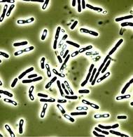 Bakterien der Art Bacillus cereus unter dem Mikroskop. Die weißen Einschlüsse in den stäbchenförmigen Bakterien sind Sporen, die auch bei Hitze überleben. © S. Scherer / TUM