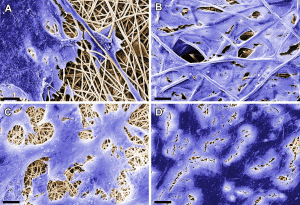 Das Vlies aus Hightech-Fasern ersetzt menschliches Gewebe. Die rasterelektronenmikroskopischen Aufnahmen zeigen mit Zellen besiedelte elektrogesponnene Trägersubstrate. © Fraunhofer IGB