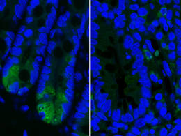 Die Bilder zeigen Paneth-Zellen im Dünndarm, die bei der Immunabwehr eine wichtige Rolle spielen. Bei Mäusen mit Morbus-Crohn-ähnlicher Entzündung produzieren die Paneth-Zellen weniger Lysozym - eine Substanz, die wichtig für die Mikroben-Abwehr ist. Links: gesunde Zellen mit hoher Lysozym-Produktion (helles grün), rechts geschädigte Paneth-Zellen mit geringer Lysozym-Produktion. © M. Schaubeck / TUM