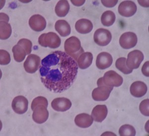 Mikroskopische Aufnahme eines Blutausstrichs: ein eosinophiler Granulozyt zwischen roten Blutkörperchen. © Bobjgalindo, Wikimedia Commons. CC BY-SA 4.0.