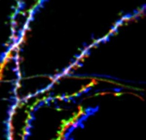 Nervenzelle im Hippocampus: Die baumförmigen Verästelungen der Zelle sind mit kleinen Auswüchsen besetzt, den synaptischen Dornen. Auf diesen Dornen sitzen die Synapsen, mit denen die Zelle mit anderen Nervenzellen in Verbindung steht. © MPI f. Psychiatrie / A. Attardo