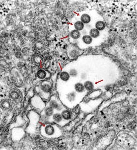Rifttal-Fieber-Viren in infiziertem Gewebe. © Wikimedia Commons. public domain.