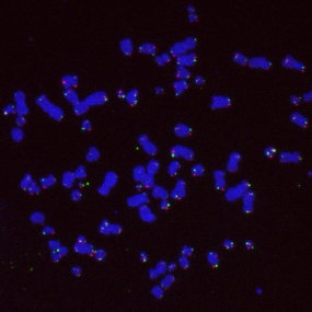 Chromosomen einer Tumorzelle, die ihre Telomere (pink und grün) auf dem alternativen Weg verlängert | © dkfz.de
