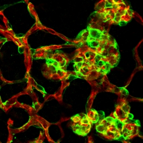 Gefäße sprossen bei der Frühgeborenen-Retinopathie aus (rot: Endothelzellen, grün: Wandzellen (Perizyten)). © Andreas Fischer /DKFZ