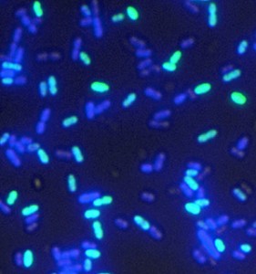 Das Kariesbakterium Streptococcus mutans unter dem Fluoreszenzmikroskop. Alle Zellen, die Bakteriozin herstellen, sind blau gefärbt. In den hellgrünen Zellen ist außerdem die Fähigkeit, fremde DNA aufzunehmen, vorhanden. © HZI