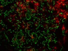 Gewebeschnitt durch den menschlichen Thymus: Verstreut zwischen den medullären Thymusepithelzellen (grün) liegen kleine Inseln von B-Zellen (rot). © Sheena Pinto,DKFZ