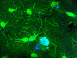 Zwei-Photonen-Mikroskopie: Aufnahme von Zellen (grün) und Amyloid-β Plaques (blau) im Alzheimer-Gehirn. © Marc Aurel Busche / TUM