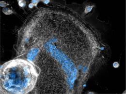 MGCs und Fresszellen (Makrophagen) wurden mit Membran-spezifischen (grau) und Zellkern-spezifischen (blau) Farbstoffen gefärbt. Auf dem Bild sind zwei Riesenzellen zu sehen (Mitte und unten links), die von einigen kleineren, einkernigen Fresszellen umgeben sind. © Ronny Milde / TUM