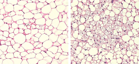 Mikroskopieaufnahmen von grossen (links) und kleinen (rechts) Fettzellen (Bild: ETH Zürich/Labor für Translationale Ernährungsbiologie)