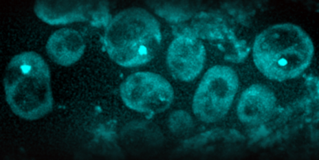 Wissenschaftler fanden in Hefezellen Proteinaggregate (helle grüne Flecken). Mit zunehmendem Alter werden diese zahlreicher (mikroskopische Aufnahme). (Bild: ETH Zürich / Juha Saarikangas)