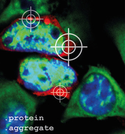 Damit Proteinaggregate (rot) in den Zellen unter dem Mikroskop sichtbar sind, müssen sie vorher angefärbt werden. Der Zellkern wurde blau, und die mRNA, die Bauanleitung für Proteine, grün angefärbt.