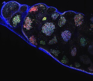 Lymphknoten einer infizierten Maus. Die verschiedenfarbigen Cluster sind Keimzentren mit unterschiedlichen Dominanz-Leveln © Gabriel D. Victora