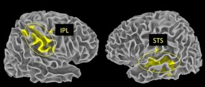 Der sogenannte Lobus parietalis inferior (IPL) im Scheitellappen bewertet negative, der Sulcus temporalis superior (STS) im Schläfenlappen interpretiert positive Ereignisse. Beide Gebiete sind Teil eines Netzwerks aus Nervenzellen, das dem Gehirn hilft, seine Umwelt zu beurteilen. © MPI f. Kognitions- und Neurowissenschaften