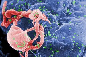 AIDS-Viren knospen aus einen infizierten Lymphozyten. © public domain.